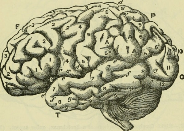 How neurodiversity in the workplace drives business success